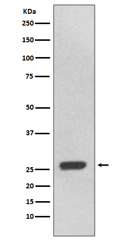 WB - Anti-UCHL3 Rabbit Monoclonal Antibody ABO13609